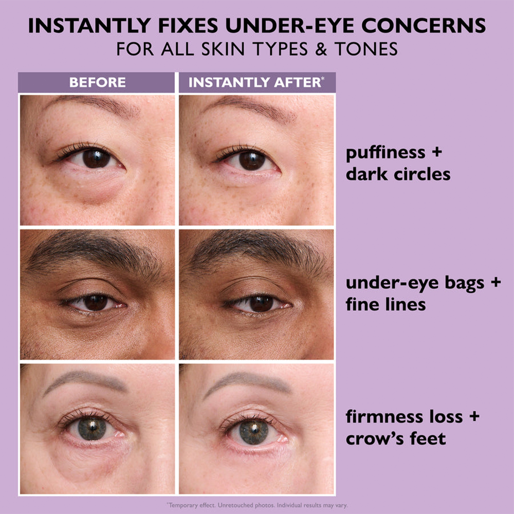 Eye Tightener